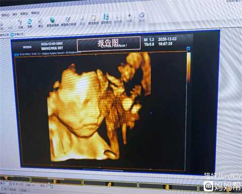 武汉代孕妈妈网：多摄食一些排毒食物可减轻身