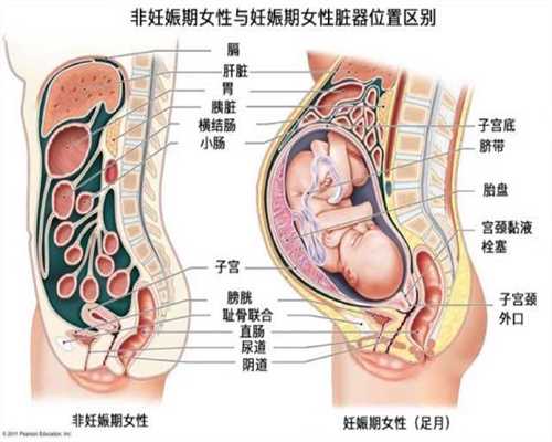 武汉代孕一个孩子花费_寻求+武汉大学生+代孕_女