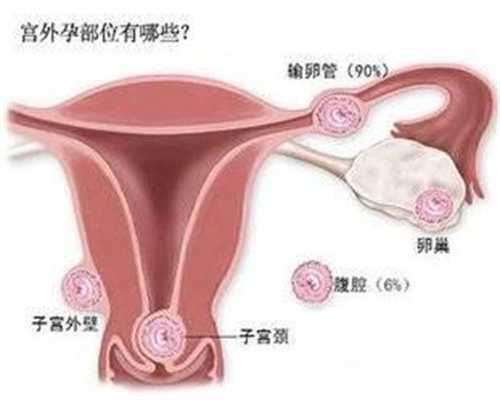 武汉代孕选男女_武汉国际医疗代孕产子价格及流程