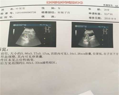 武汉供卵医院在哪里_武汉第一代试管婴儿成功率