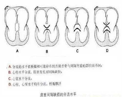 武汉公立医院做供卵试管_三代生子怎么联系_胸透、胸片和ct区别打！不同检查